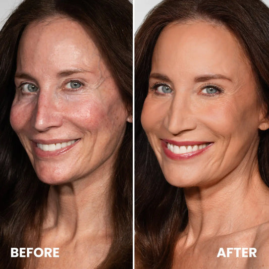 The Truth About Aging Skin: Why Makeup Alone Isn’t Enough